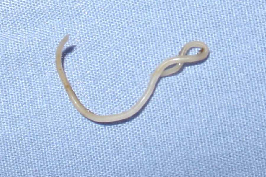 Roundworm from dog